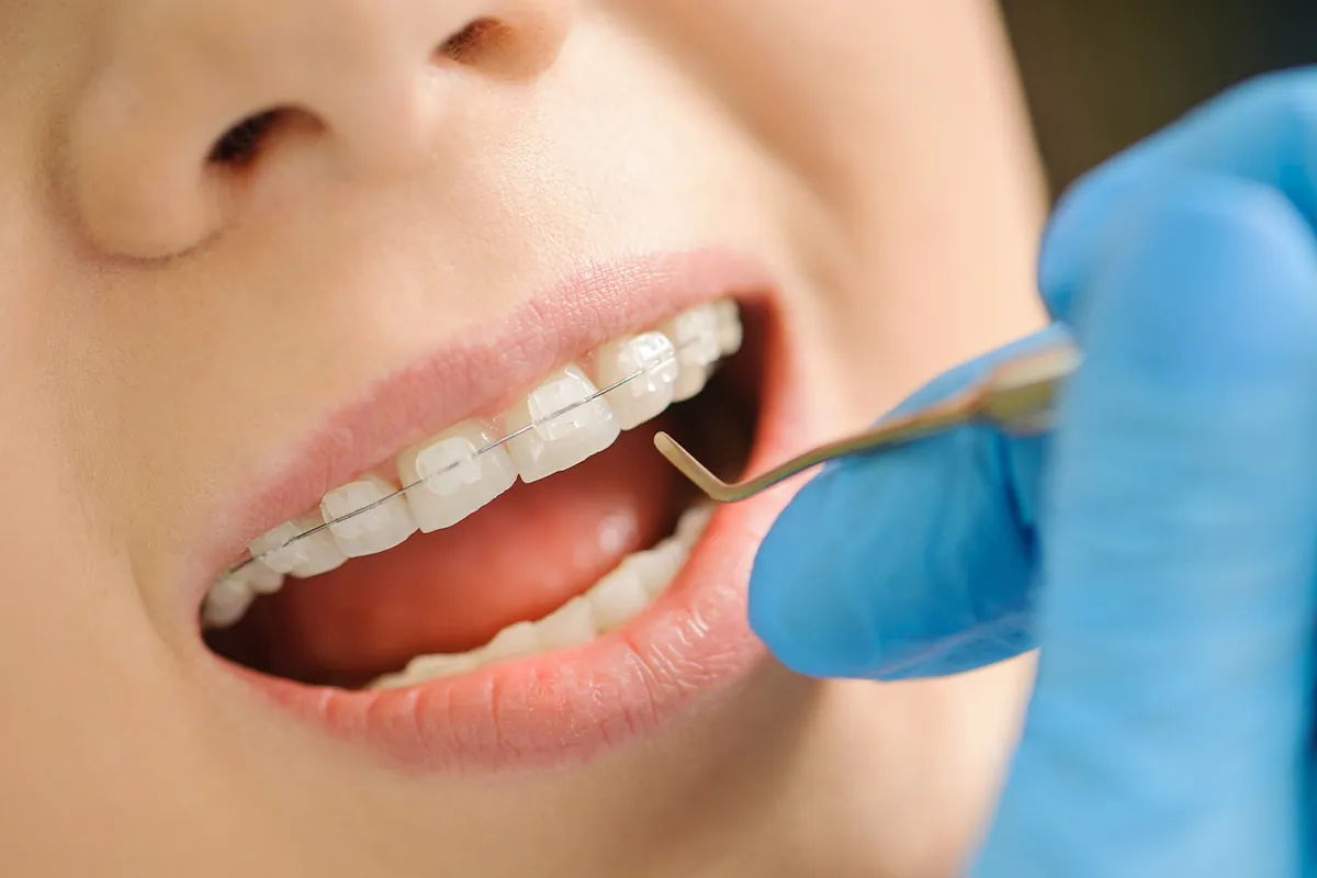 Preventive Dentistry at Lava Dental in Houston, TX