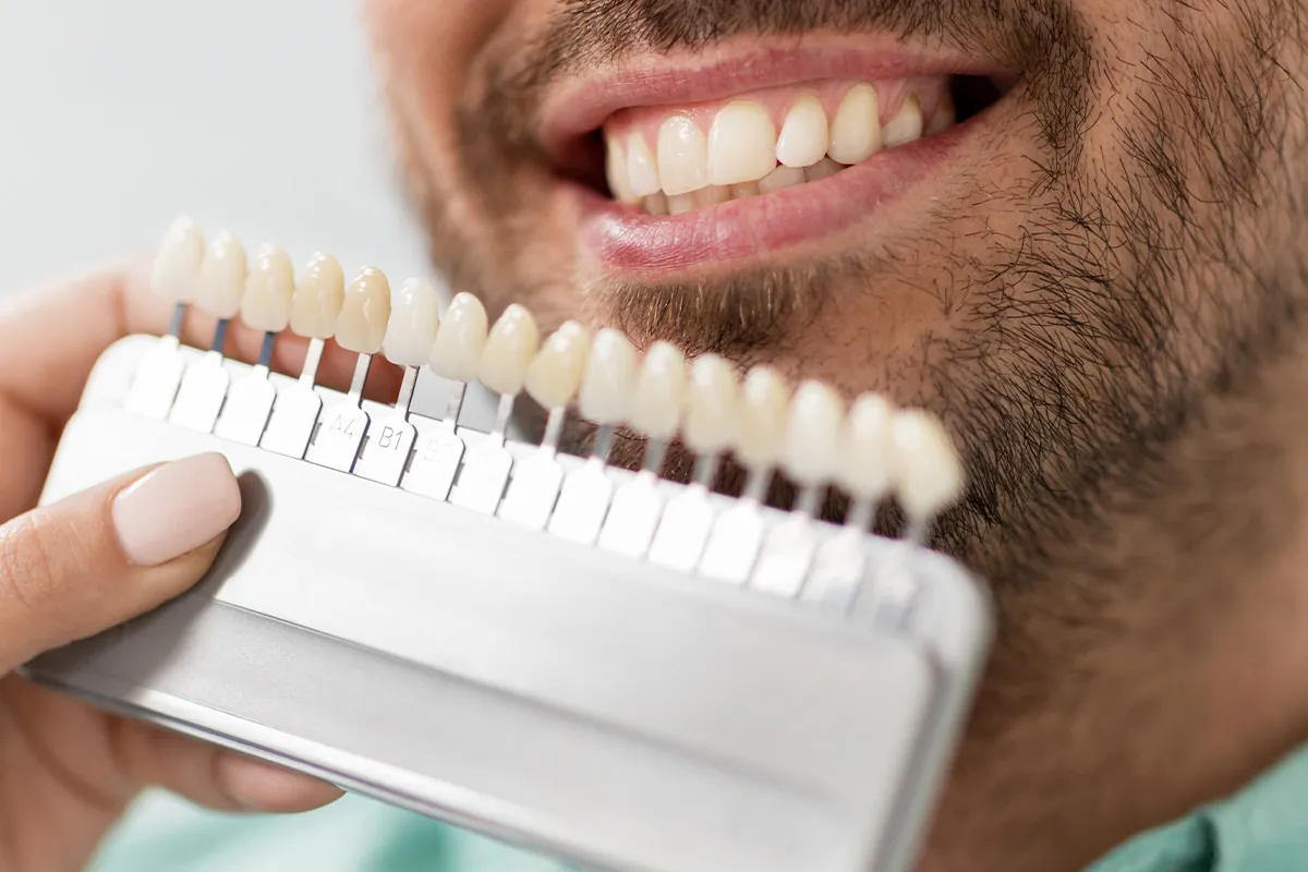 How Often Should I Whiten My Teeth?