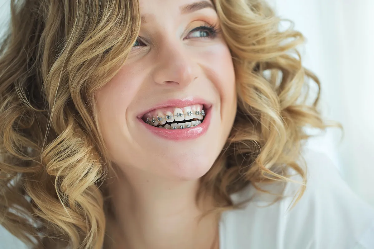 Fastbraces at Lava Dental