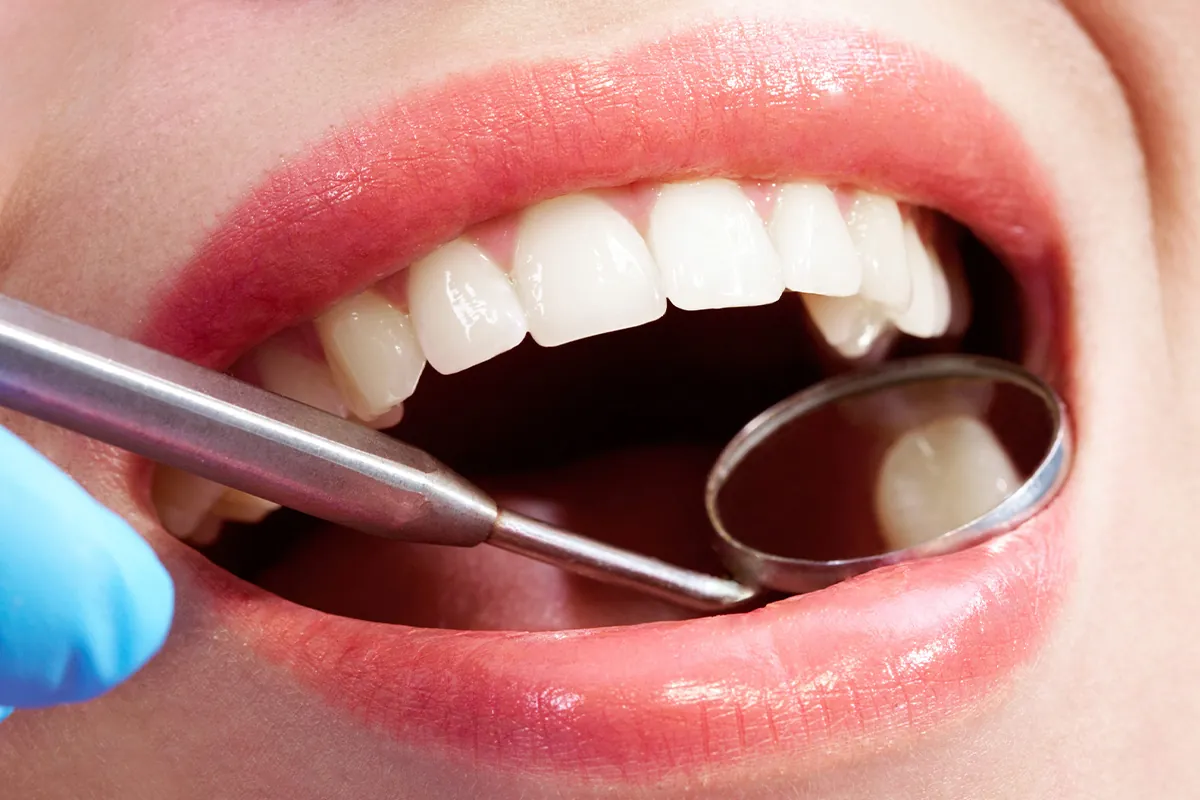 Dental Exams & X-Rays at Lava Dental