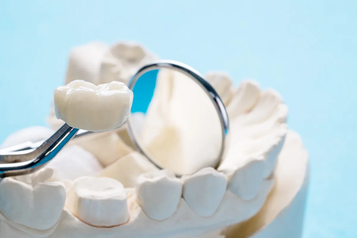 Dental Crowns at Lava Dental