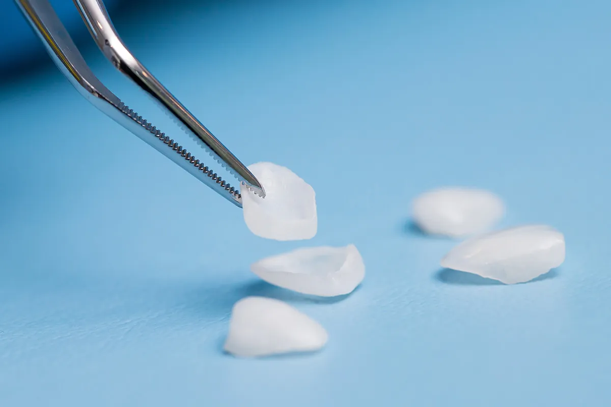 Veneers at Lava Dental