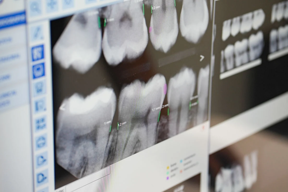 Advanced dental technology at Lava Dental