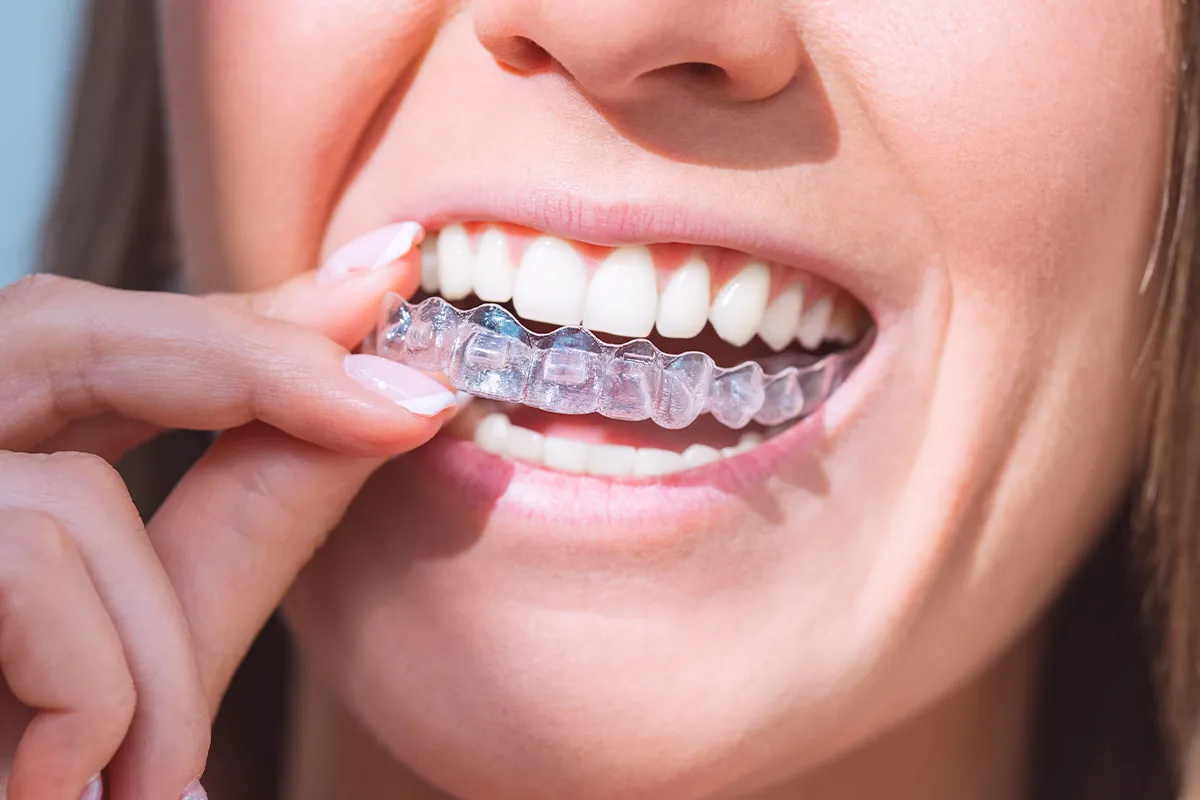 TMJ Treatment at Lava Dental