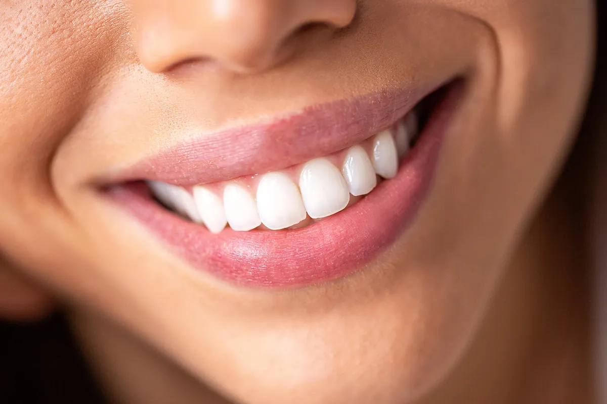 Full Mouth Reconstruction at Lava Dental