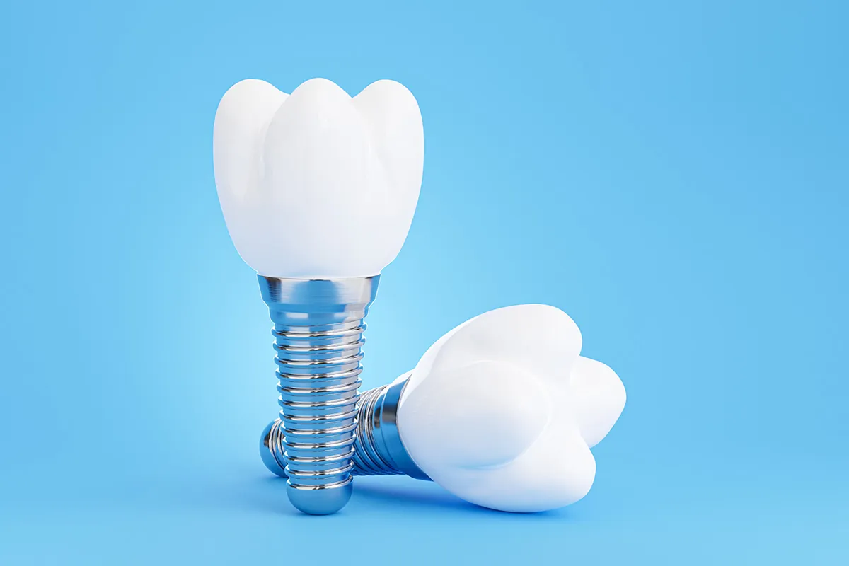 Unlocking Smile: The Secret Benefits of Mini Dental Implants
