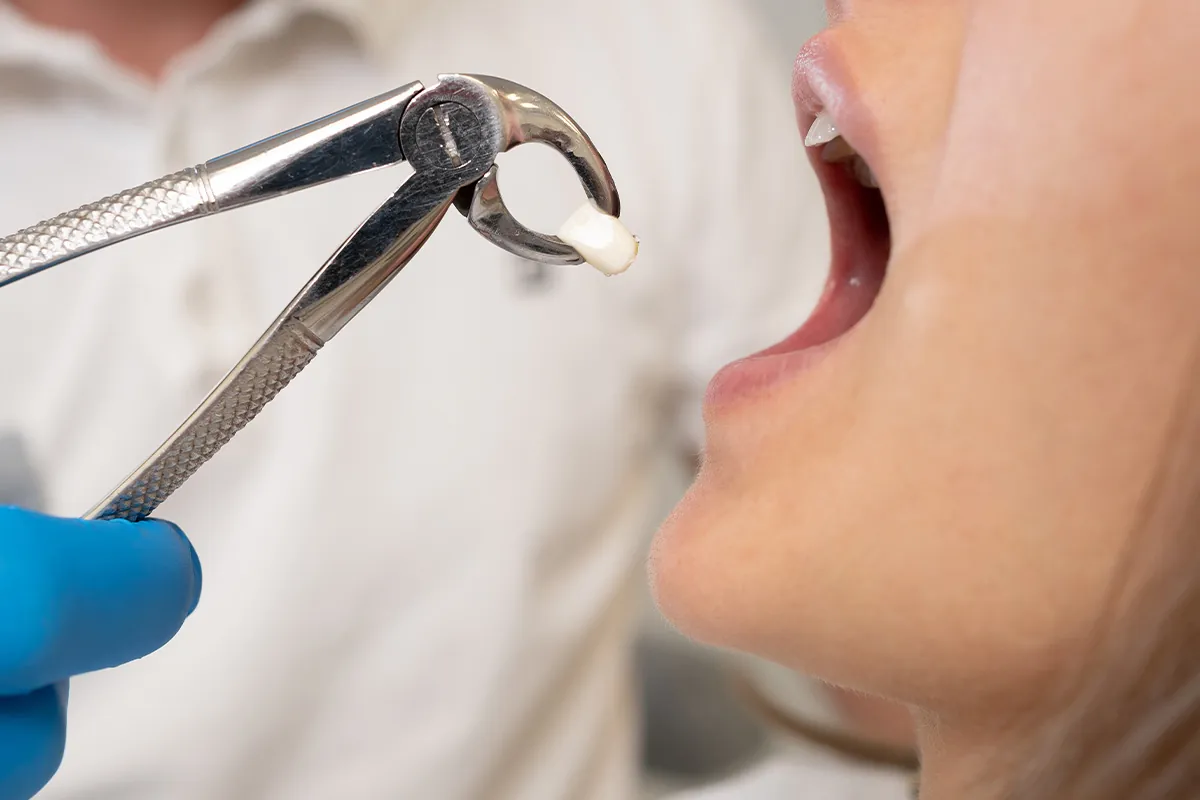 Oral Surgery at Lava Dental in Houston, TX