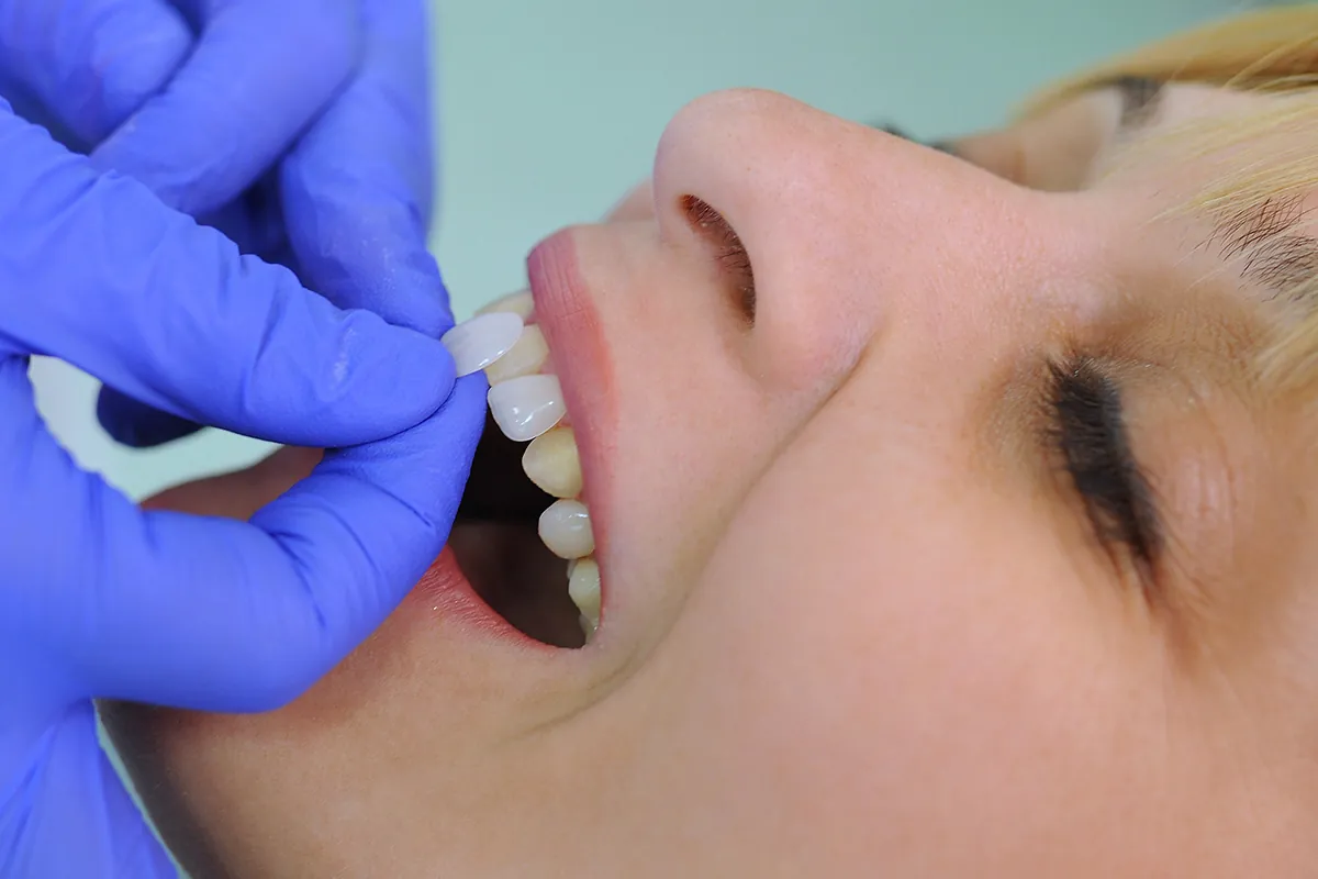 Cosmetic Dentistry at Lava Dental